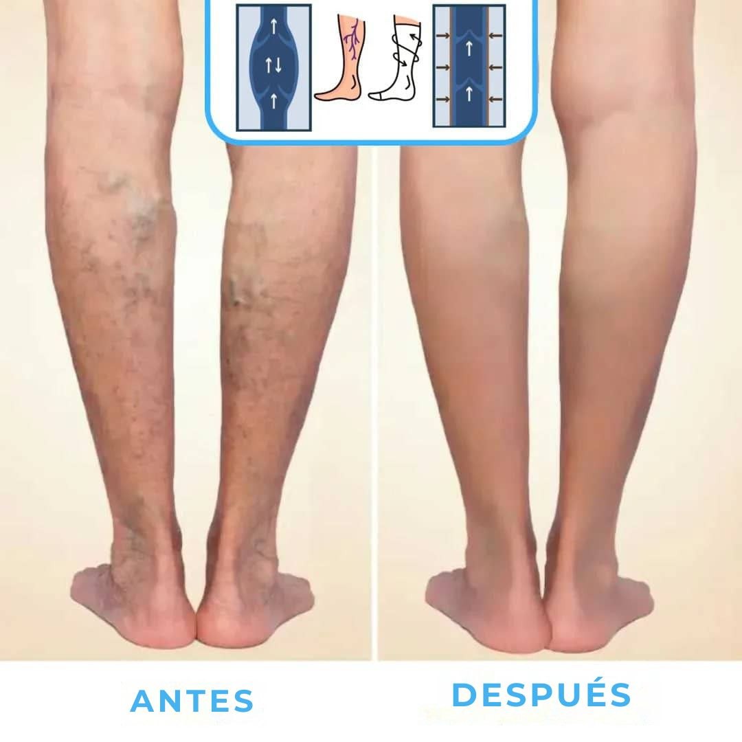 FlowSocks™ - Calcetines de compresión