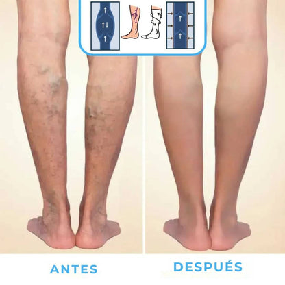 FlowSocks™ - Calcetines de compresión